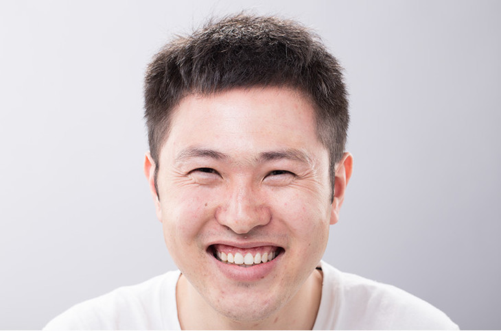 阿飞性格超好,特爱笑,但这也让他的鱼尾纹很多,现在就算不笑也有很多