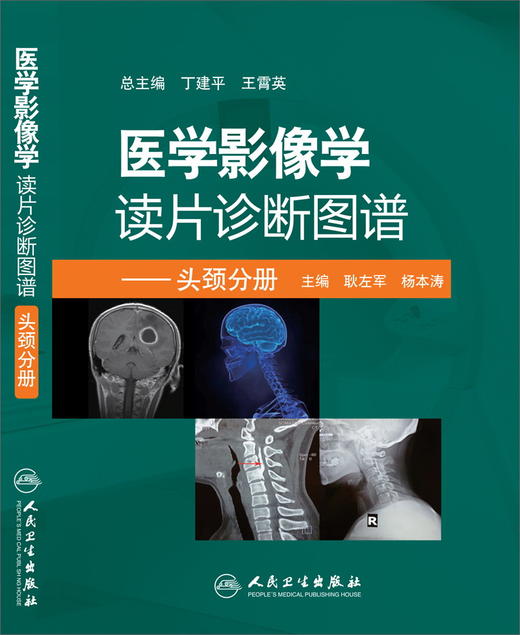 医学影像学读片诊断图谱---头颈分册 商品图0