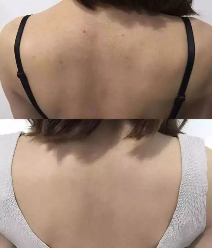 米澳拉·黄糖去角质凝胶,温和祛角质污垢,皮肤更软滑透亮,韩国miorio