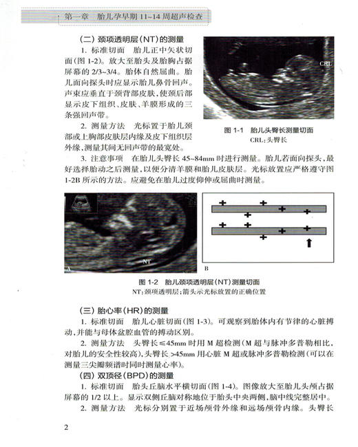 中国胎儿产前超声检查规范 人卫版 姜玉新主编 中华医学会超声医学分会编著 西医 人民卫生出版社 胎儿产前超声检查 产科 超声医学 商品图4