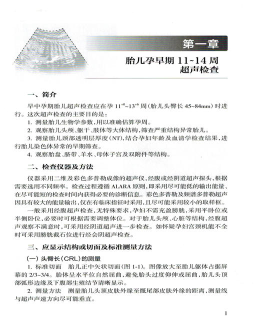 中国胎儿产前超声检查规范 人卫版 姜玉新主编 中华医学会超声医学分会编著 西医 人民卫生出版社 胎儿产前超声检查 产科 超声医学 商品图3