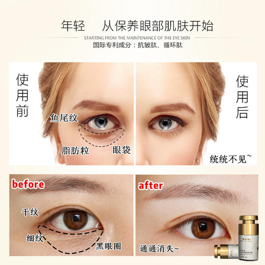 限前1000名买即送蛋壳保养膜御姿澜类箭毒多肽保湿滋养修护眼霜抚平干