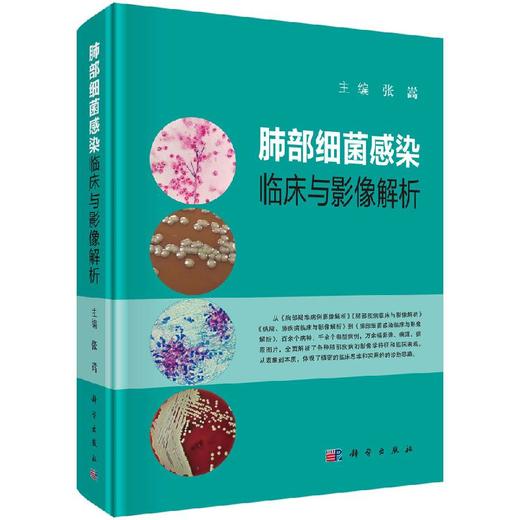 肺部xi菌感染临床与影像解析/张嵩 商品图0