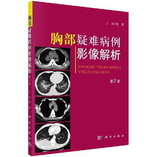 胸部疑难病例影像解析（第二版）张嵩/科学出版社 商品图0