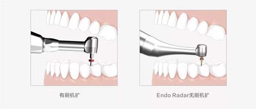 啄木鸟Endo Radar 无刷机扩（稳中有静，静中有力） 商品图7