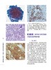 宫颈癌筛查及临床处理：细胞学、组织学和阴道镜学 商品缩略图3