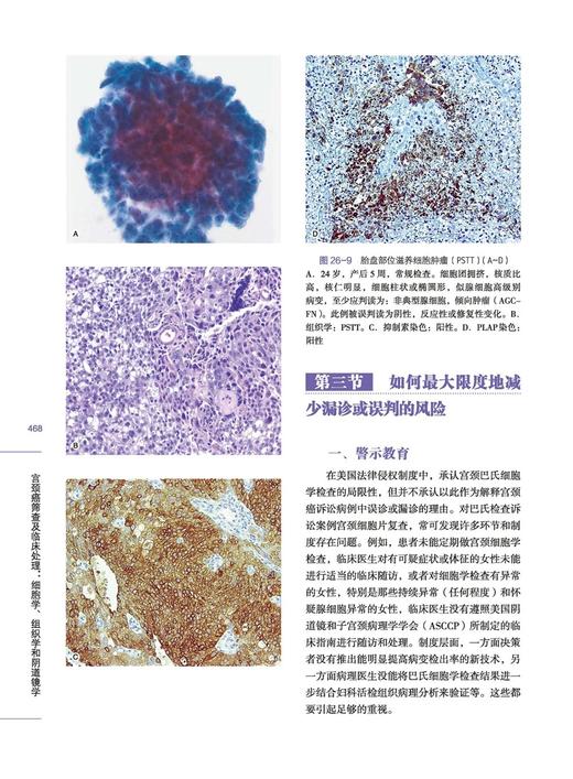 宫颈癌筛查及临床处理：细胞学、组织学和阴道镜学 商品图3