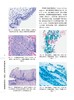 宫颈癌筛查及临床处理：细胞学、组织学和阴道镜学 商品缩略图2