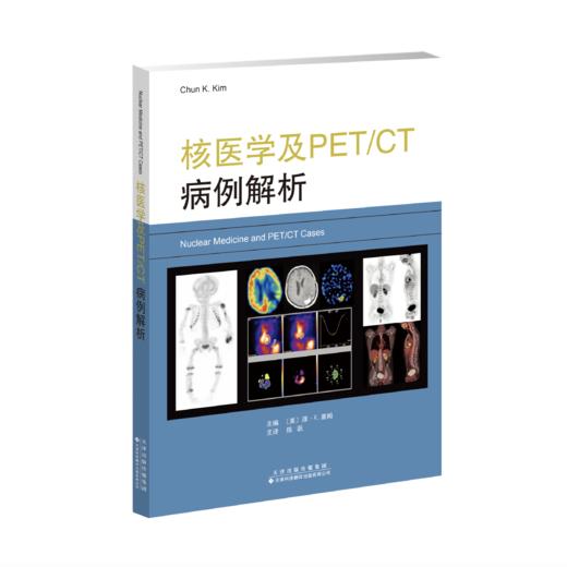 核医学及PET/CT病例解析 商品图0