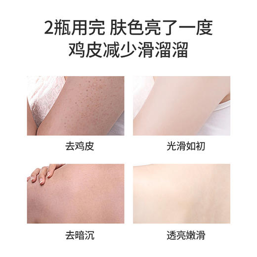 【小植补贴】ZLCA-身体磨砂膏烟酰胺乳木果全身去角质鸡皮 商品图3