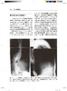 成人腰椎侧凸 李明 译 北医社 商品缩略图5