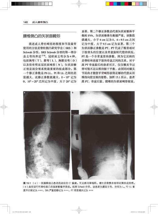 成人腰椎侧凸 李明 译 北医社 商品图5