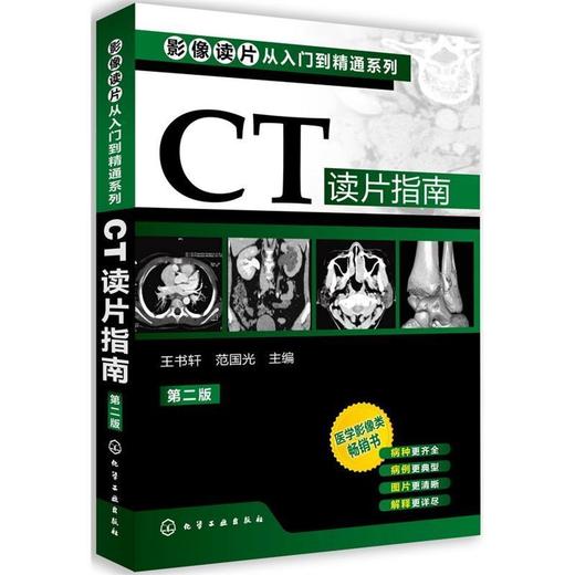 影像读片从入门到精通系列--CT读片指南(二版) 商品图0