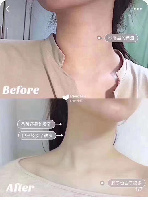 Xhekpon西班牙颈纹霜去淡化颈纹提拉紧致颈霜(范冰冰推荐) 商品图3