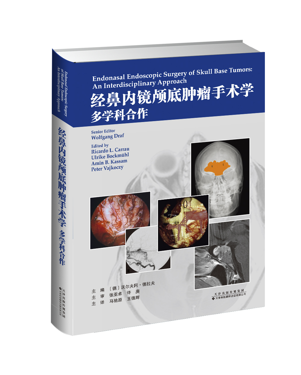 经鼻内镜颅底tumor手术学：多学科合作