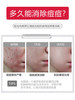 草本痘净霜 20g（又叫：草本抑菌膏） 商品缩略图2