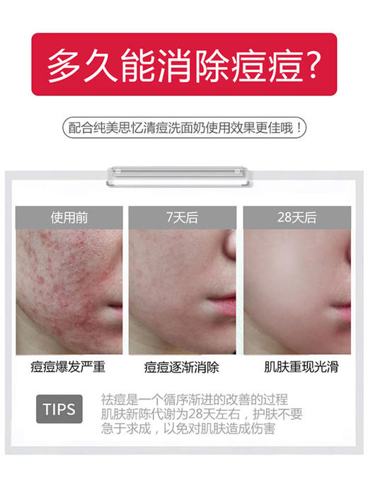 草本痘净霜 20g（又叫：草本抑菌膏） 商品图2