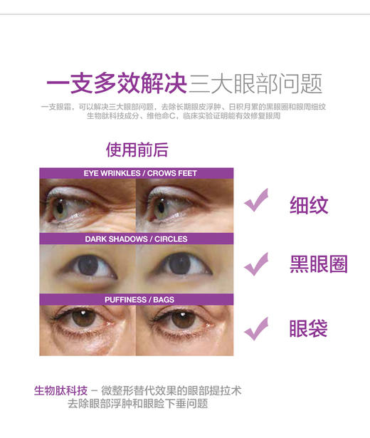 【新西兰直邮】澳洲freezeframe眼霜15ml 生物多胜肽 提拉紧致去眼袋黑眼圈JPY带授权招加盟代理 商品图8