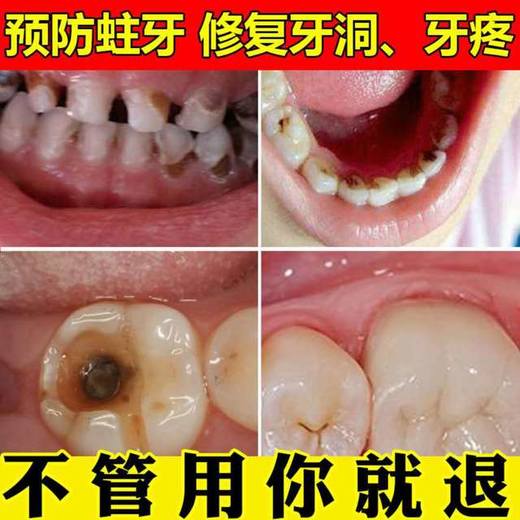 【牙痛克星，一喷止痛】快.准.狠，天然本草植物提取，3分钟快速止痛，温和不刺激，一喷管用一整天 商品图3