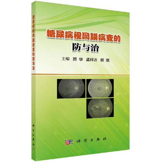 糖尿病视网膜病变的防与治 商品图0