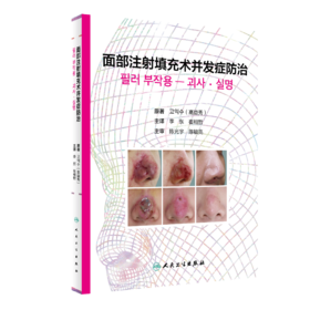 面部注射填充术并发症FANG治