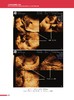 《子宫内膜异位症超声诊断》 商品缩略图1
