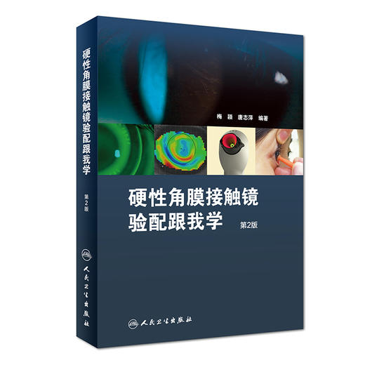 硬性角膜接触镜验配跟我学(第2版) 商品图0