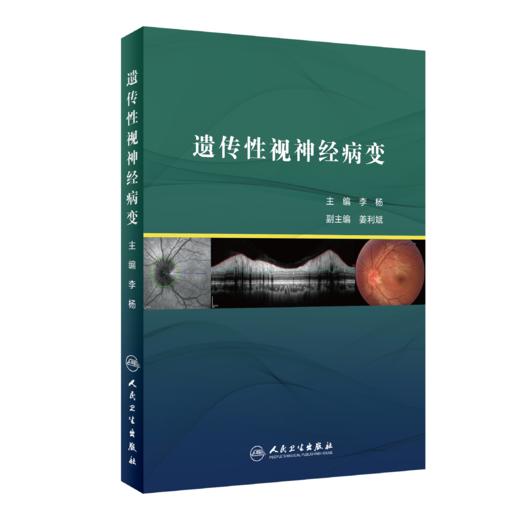 遗传性视神经病变 商品图0