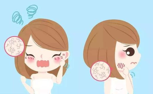 秋冬皮肤管理   教你如何抵抗“问题肌”？ 商品图1