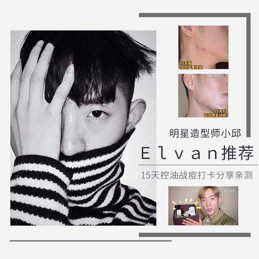 【小善精选】善草纪澳洲茶树水乳霜套装  油田痘肌控油祛痘收缩毛孔 商品图2