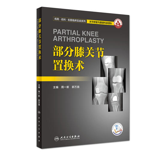 部分膝关节置换术 商品图0
