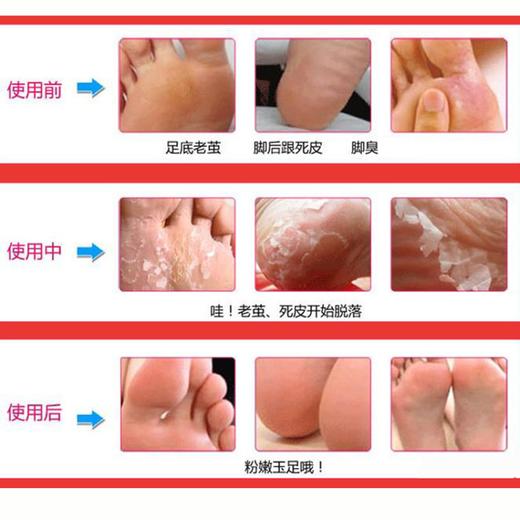 【天然温和蜕皮 重现嫩脚丫】脚膜牛奶嫩脚袪死皮脚臭足膜2对装 商品图5