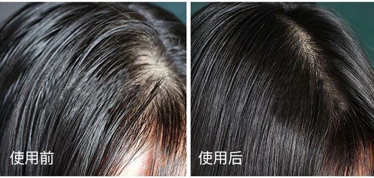 这种 养发生发功效,可是取得了 国家专利认证,在市面上都少之又少.