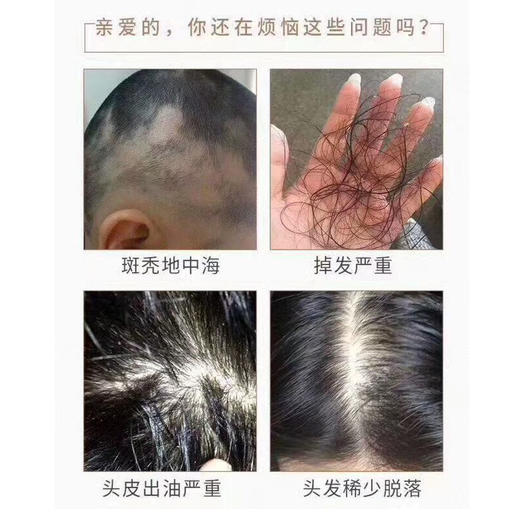 贝特优美毛发生长液30ml 商品图2