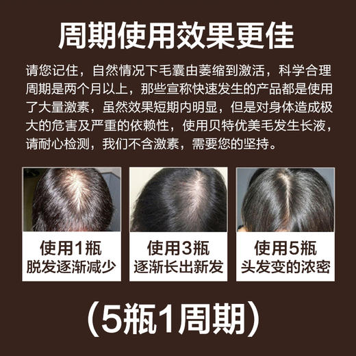 贝特优美毛发生长液30ml 商品图1