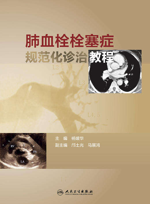 肺血栓栓塞症规范化诊治教程 商品图1