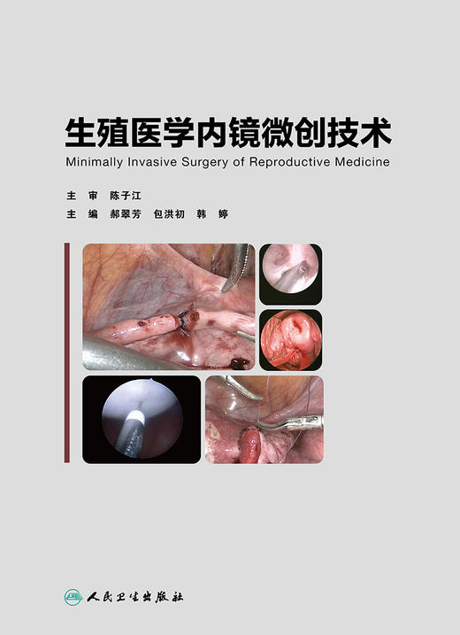 生殖医学内镜微创技术 商品图1