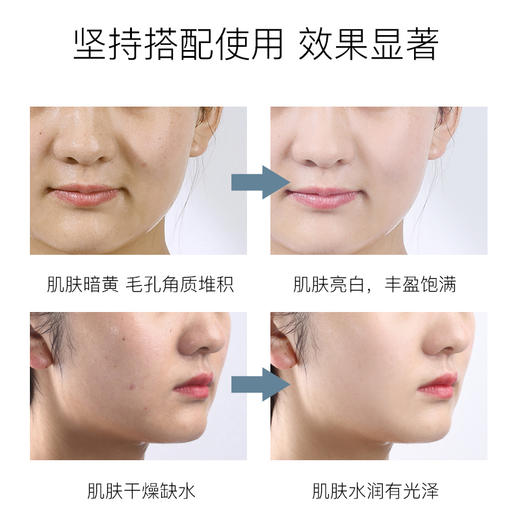 【万宁行货】蒂佳婷药丸面膜5p 商品图4