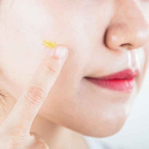 片仔癀牌祛痘凝胶、祛痘修护膏｜修复舒缓痘痘，淡化痘印 商品图2