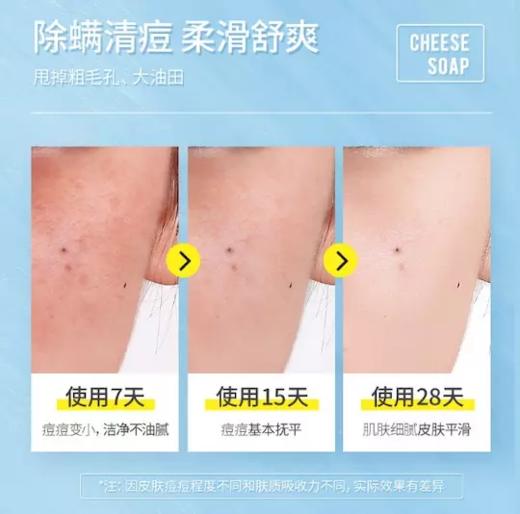 【买一送一，加赠起泡网】 网红芝士拉丝皂，清洁毛孔，水润滋养，舒缓不油腻，温和养肤，丰富泡沫，手工工艺 商品图1