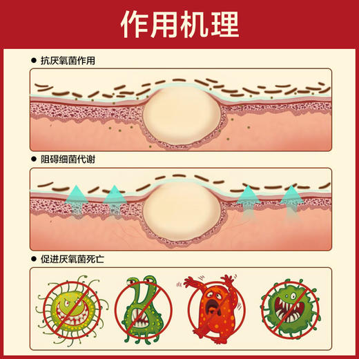 碧生源甲硝唑凝胶20g/盒   祛痘毛囊炎脓疱红鼻子 商品图3