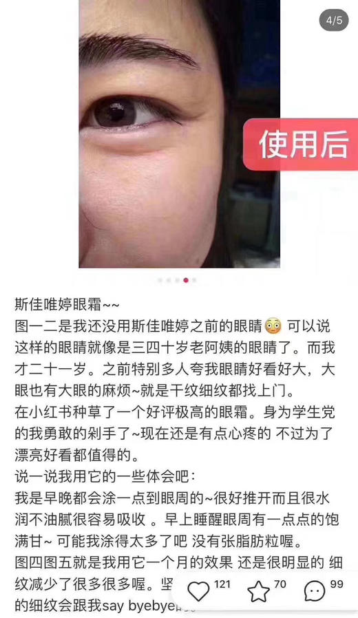 上架！Strivectin斯佳唯婷精湛祛皱纹修复眼霜15ml+5ml 商品图6