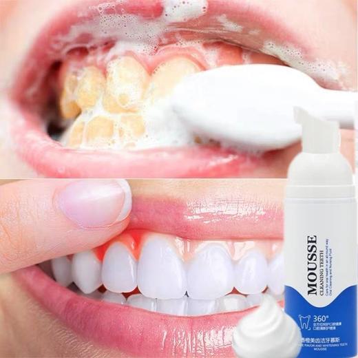 【拍1发1，拍2发3】芊语寇口腔护理居家日用洁牙慕斯 商品图2