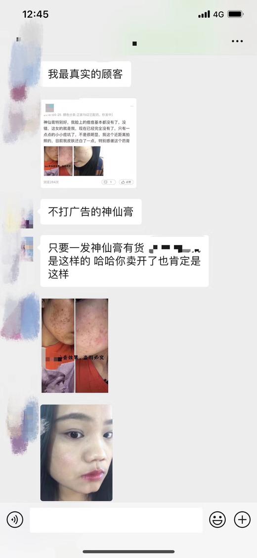 (全.网.独.家)神仙膏祖.传专治烂脸去痘膏去痘红肿青春痘闭口粉刺痘印学生脸部后背 商品图7