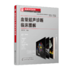 临床常见疾病超声图谱系列--血管超声诊断临床图解 商品缩略图0