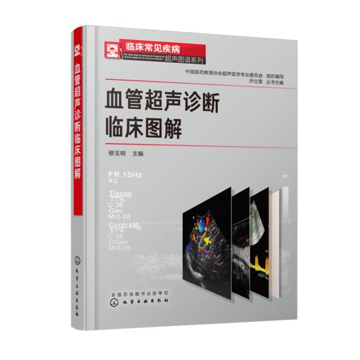 临床常见疾病超声图谱系列--血管超声诊断临床图解 商品图0