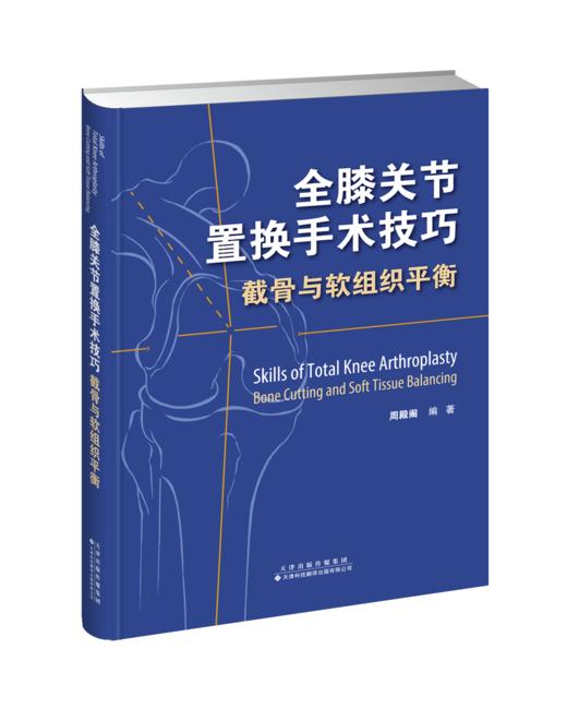 【正版保证】全膝关节置换手术技巧——截骨与软组织平衡 骨科青年 商品图0