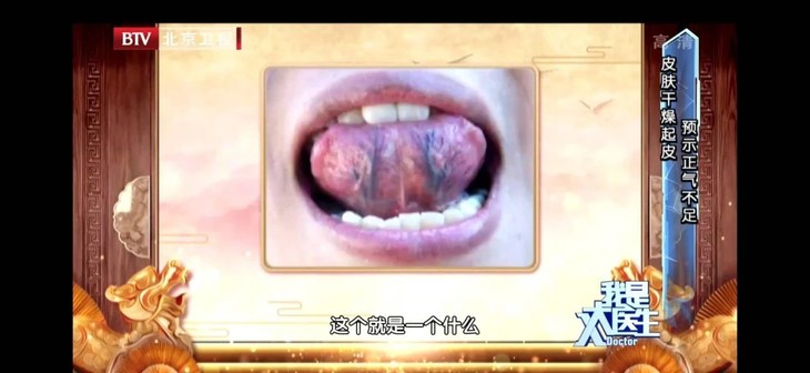 20200312 辨别体质防御外邪如何远离病毒侵袭