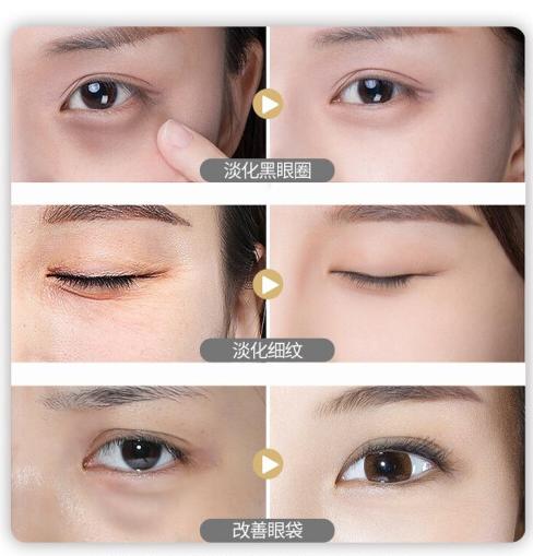 【3件5折】透蜜 多效莹润按摩眼霜15g（专区任选3件拍下立减）紧致提拉 补水保湿 淡化细纹 黑眼圈眼袋 抗皱脂肪粒女 商品图5