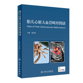 胎儿心脏大血管畸形图谱 9787117297097